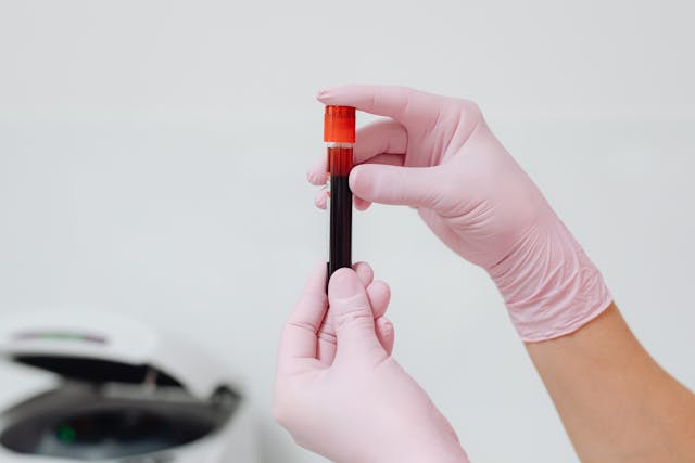 a nurse holding a blood sample