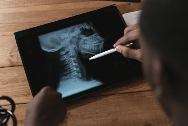 a doctor looking at an x-ray of a throat