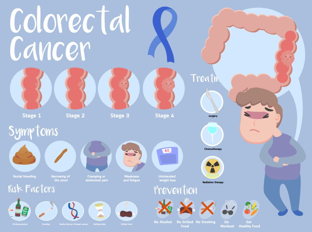 Colographic Cancer Eachcographic