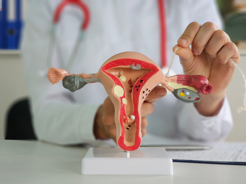 Doctor gynecologist ligates fallopian tubes on example of layout female reproductive system

