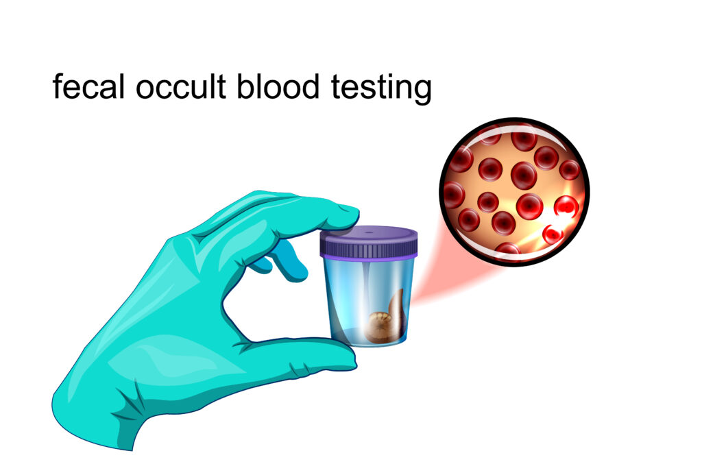 Fecal testing blood security. Vector parent
