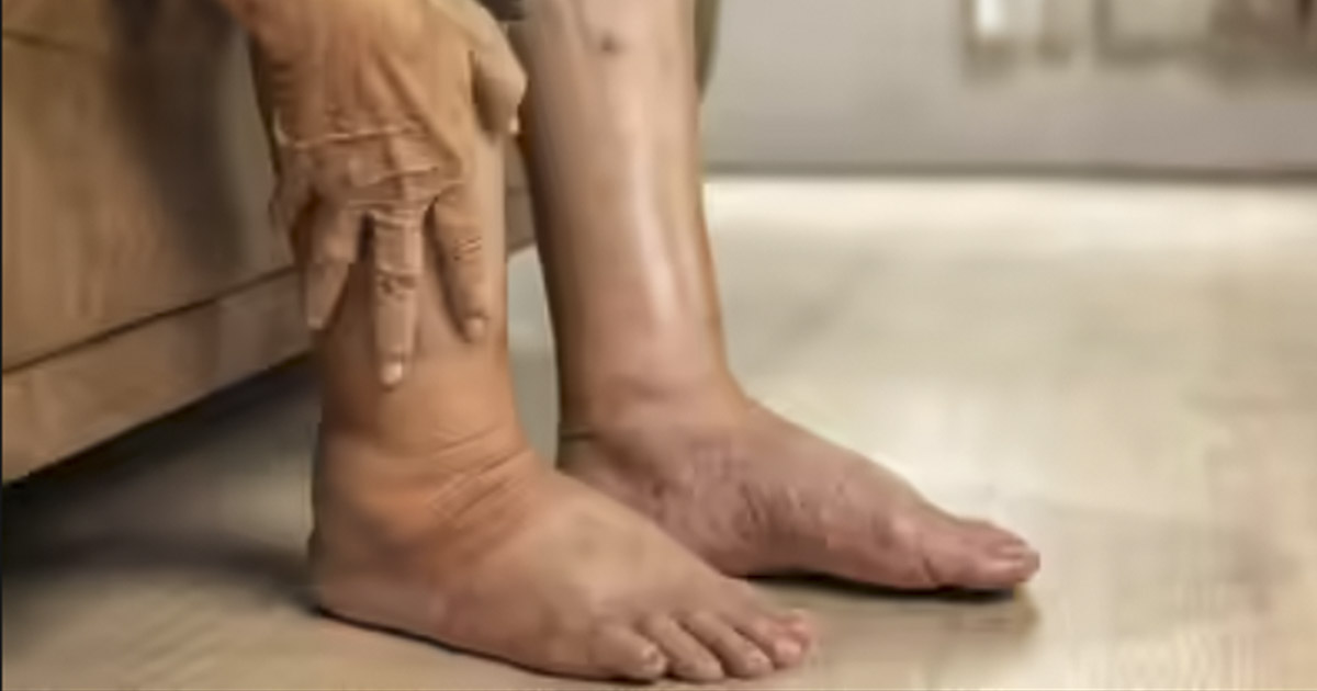 4 Leg Symptoms You Might Be Overlooking