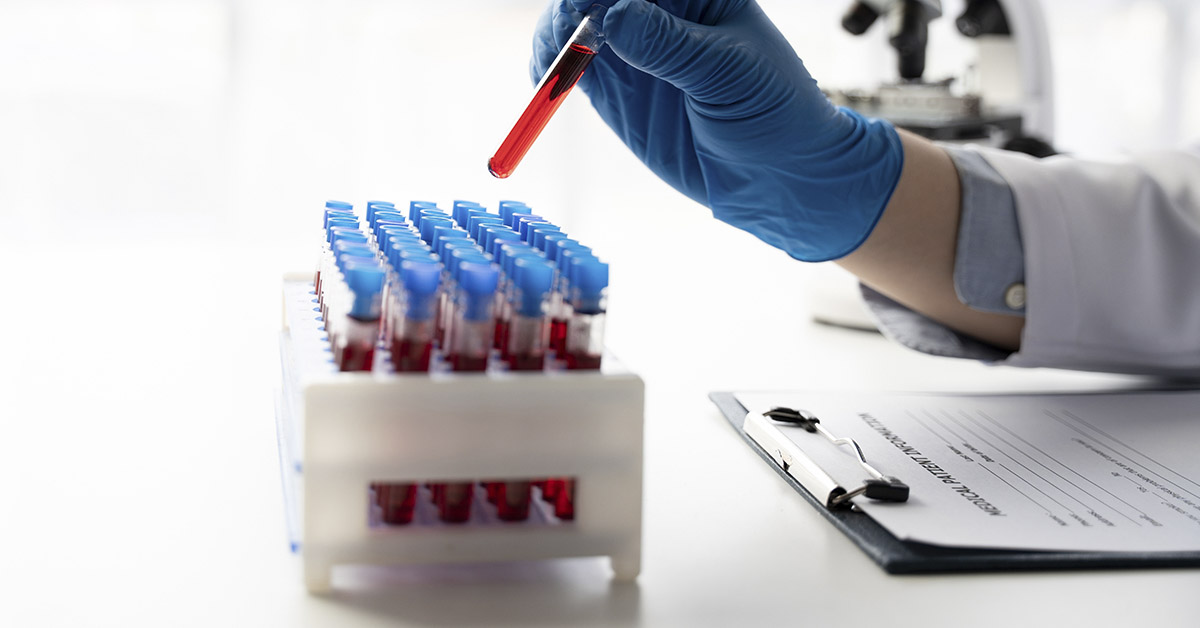 Studies Indicate That Individuals With This Blood Type Have a Higher Likelihood of Living to 100