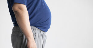 Trump Administration Flags Obesity in Latest Visa Screening Changes Man with blue shirt and grey pants. Focus on man's belly. Obesity concept