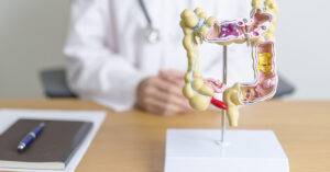 doctor using a model of the large intestine to explain information, likely related to colorectal health or cancer screening.