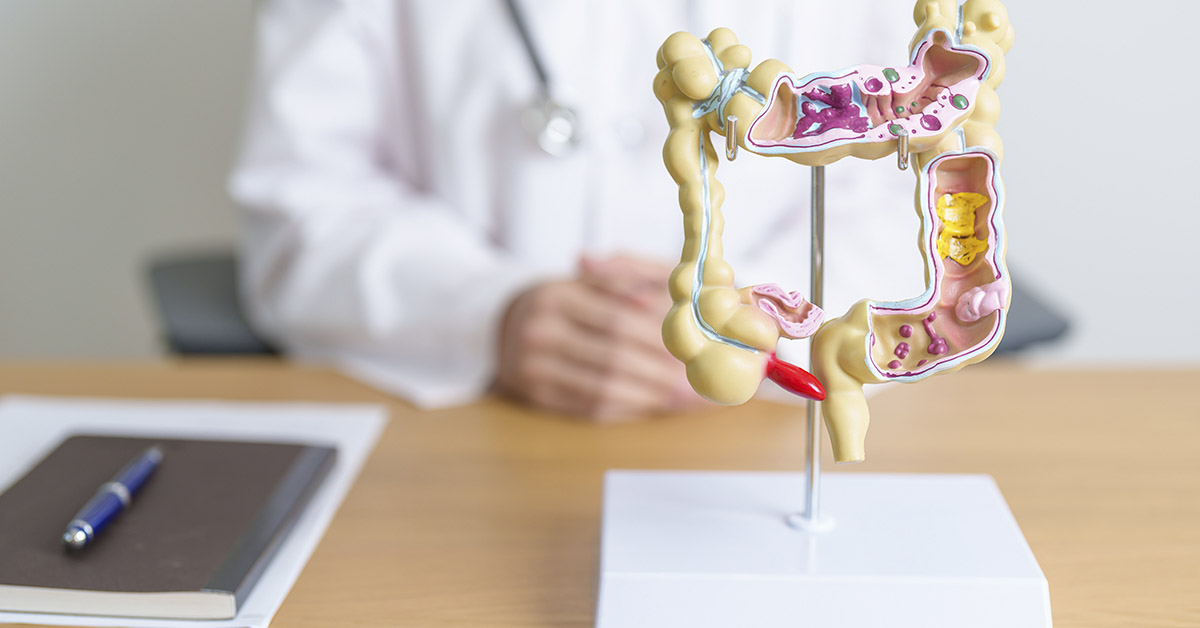 These Foods Could Be Fueling the Surge in Early-Onset Colorectal Cancer Among Women