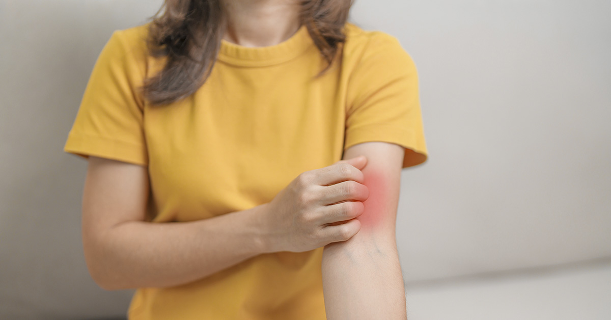 Researchers Find Strongest Link Yet Between Epstein-Barr Virus and Lupus