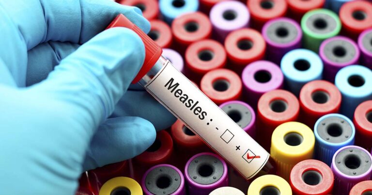 Canada Lost Its Measles Free Status, Is The U.S. Next? - Featured image