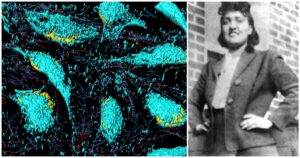 The Story of Henrietta Lacks: How a Medical Miracle Was Born from Injustice Composite image showing a 3D microscopic view of HeLa cells on the left, and a historical black-and-white photograph of Henrietta Lacks on the right, whose cells became the first immortal human cell line used in scientific research