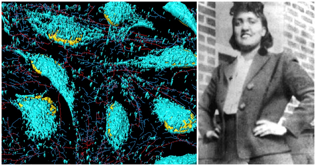 The Story of Henrietta Lacks: How a Medical Miracle Was Born from Injustice