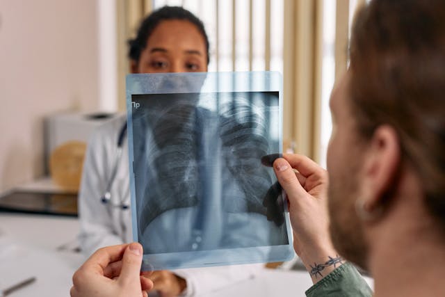 doctor examines lung x-ray