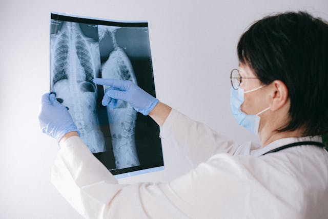 doctor pointing at x-ray