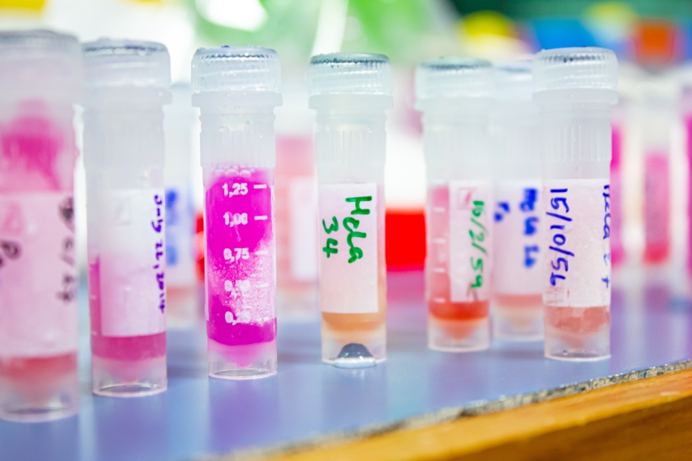 Closeup, cultures cancer cells in cryovial tubes taken from liquid nitrogen infusion to prepare drug tests for anticancer in the laboratory. Research and drug development, Medical, Pharmaceutical.