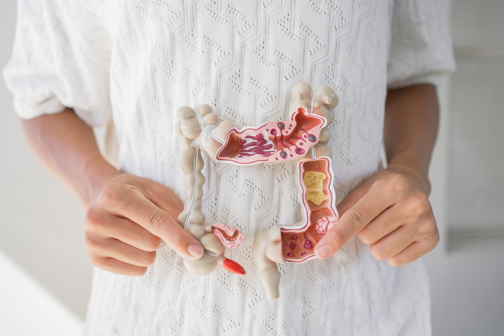 hands holding intestine model, healthy bowel digestion, leaky gut, probiotic and prebiotic for gut health, colon, gastric, stomach cancer concept
