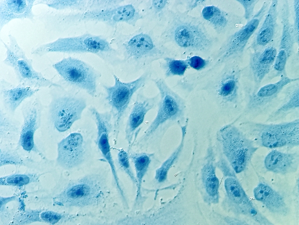 HeLa cervical cancer cells, stained with Coomassie blue, under microscope.
