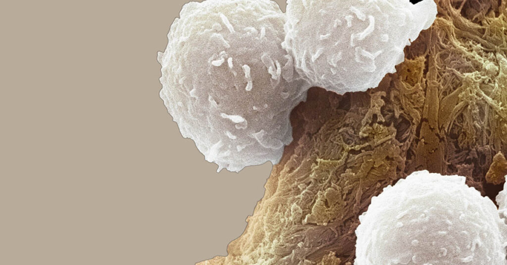 University Researchers Report Progress Toward Universal Cancer Vaccine - Featured image