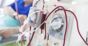 dialysis machine