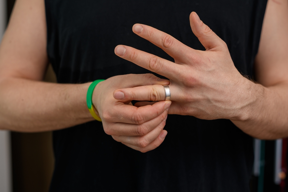 Swollen hands, difficulty in removing the ring from the finger