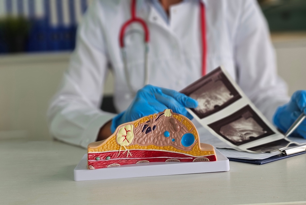 Mammologist examines photographs of female breasts and ultrasound results. Breast diseases concept