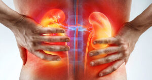 stressed out damaged kidneys
