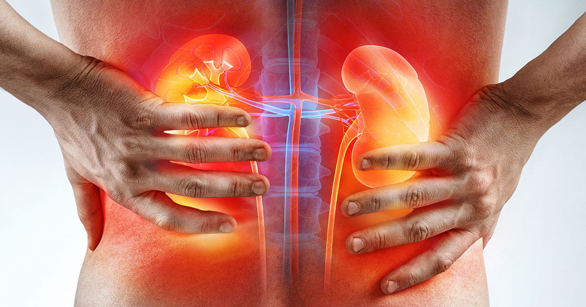8 Surprising Things That Could Be Harming Your Kidneys (And It’s Not Salt)