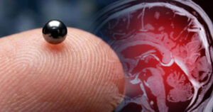 Could Microrobots Replace Pills And Injections? Scientists May Be Closer Than You Think tinyballs