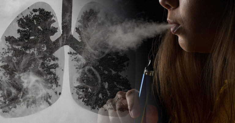 Vaping Tied to a Rare Form of Long-Term Lung Damage - Featured image