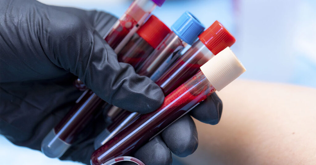 Golden Blood: Why the World’s Rarest Blood Type Is So Important - Featured image