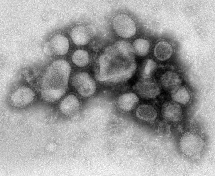 Transmission electron microscope image of influenza virus particles in grayscale, showing spherical and slightly irregular viral bodies clustered together against a light gray background.