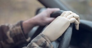 man with artificial hand driving a car