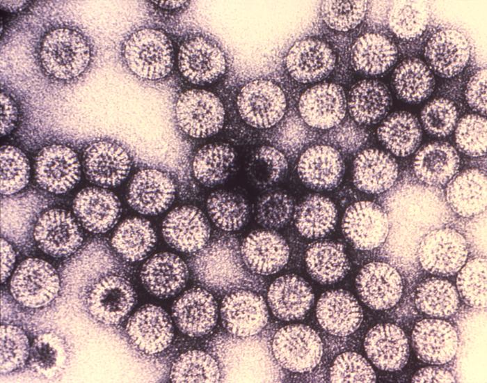 Transmission electron microscope image of hepatitis B virus particles, shown in false color as small orange spheres clustered against a mottled blue background.