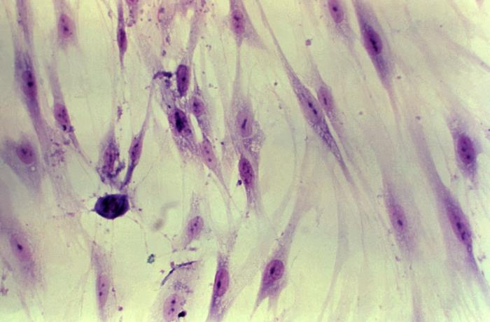 Light microscope image of liver cells stained purple and pink, showing elongated cell nuclei scattered across fibrous tissue.