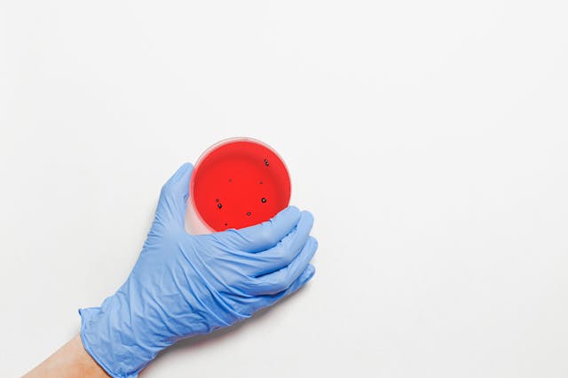 a gloved hand holding a petri dish