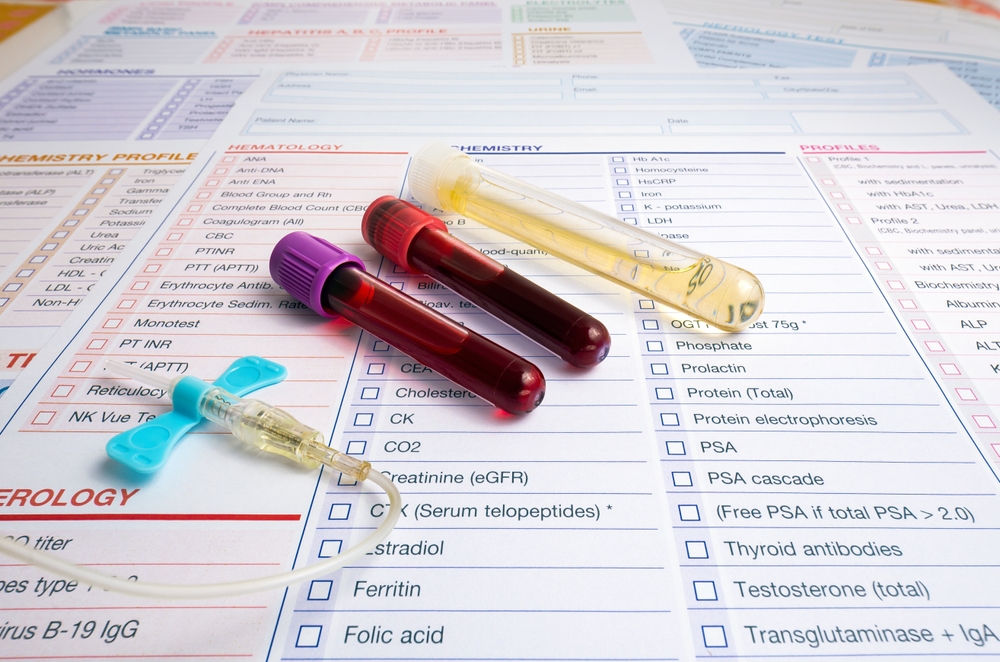 Blood tubes and urine of patient with test report for analysis in the Hematology lab. blood sample and urine collection tubes and supplies with requisition form for analysis in the clinical laboratory