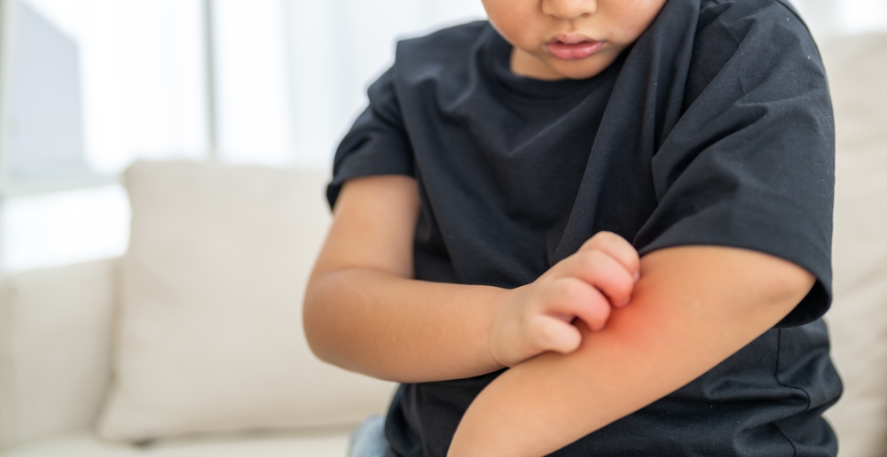 A young Asian boy affected by itching or irritation of the skin, allergic children, especially those related to skin care and health, childhood, health, skin care and daily health care.