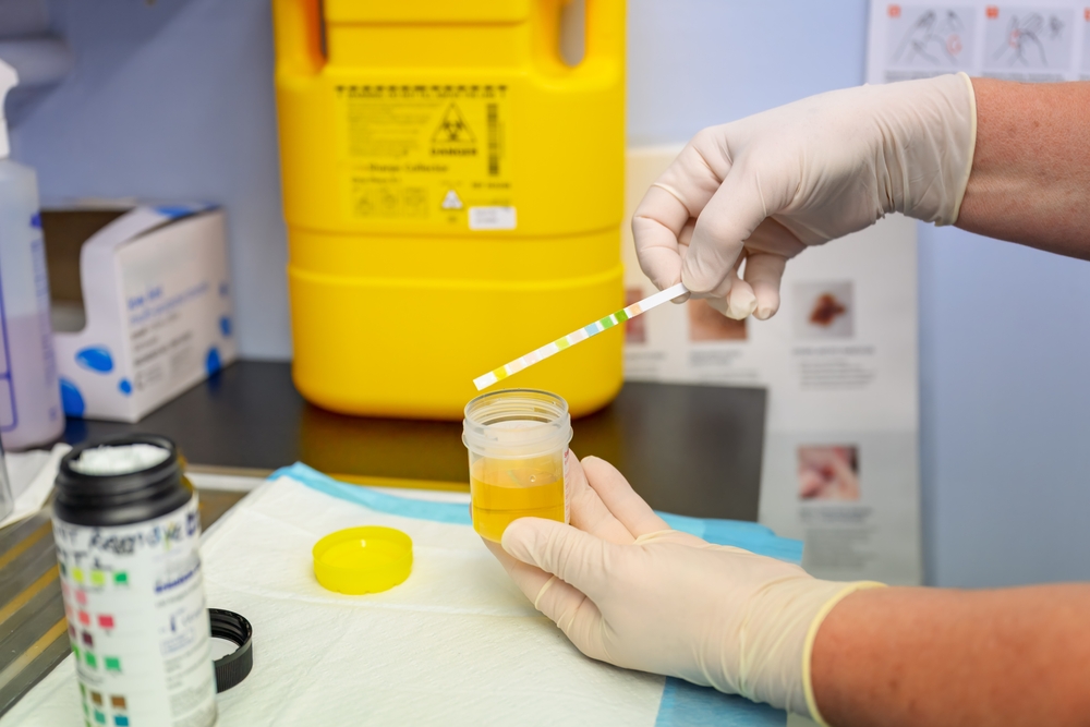 urinalysis urine specimen, testing for infection UTI, gp general practice, doctor nurse medical clinic, australia