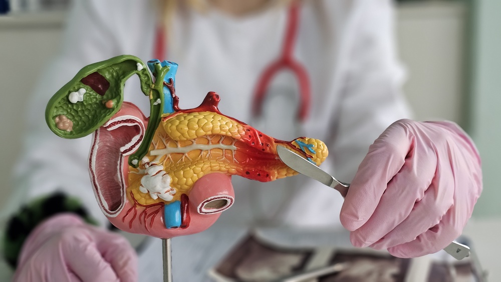 Pancreatic surgery for cancer and oncology. Pancreatic surgery. Surgery for pancreatitis