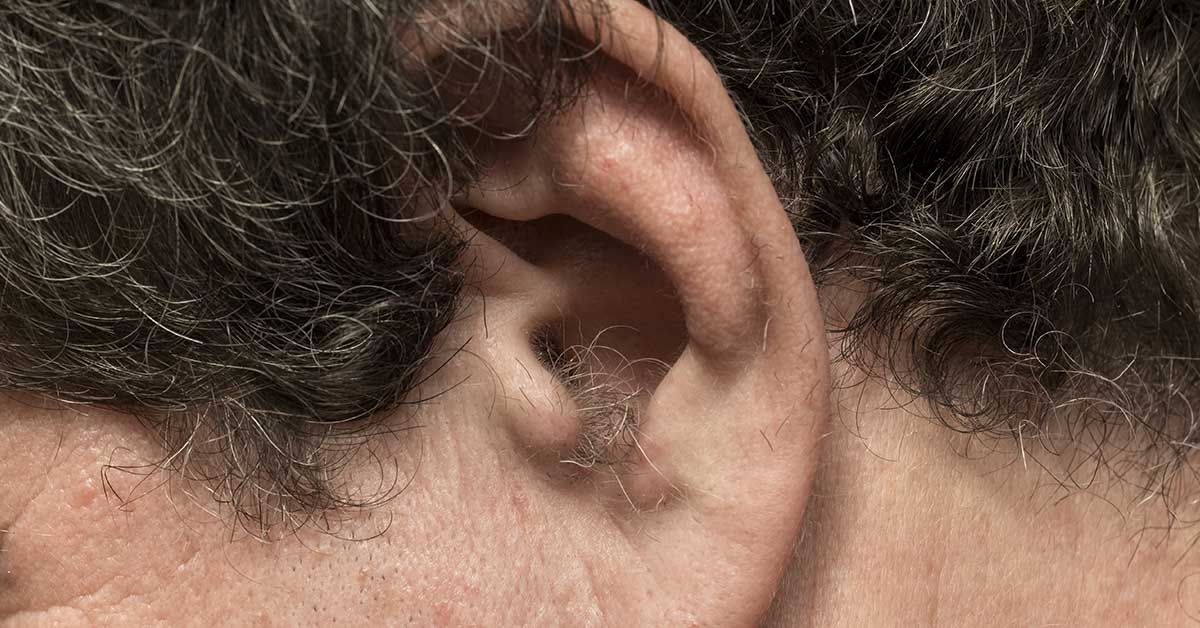 Why Do I Have So Much Ear Hair? Causes, Age Effects, and Removal Options