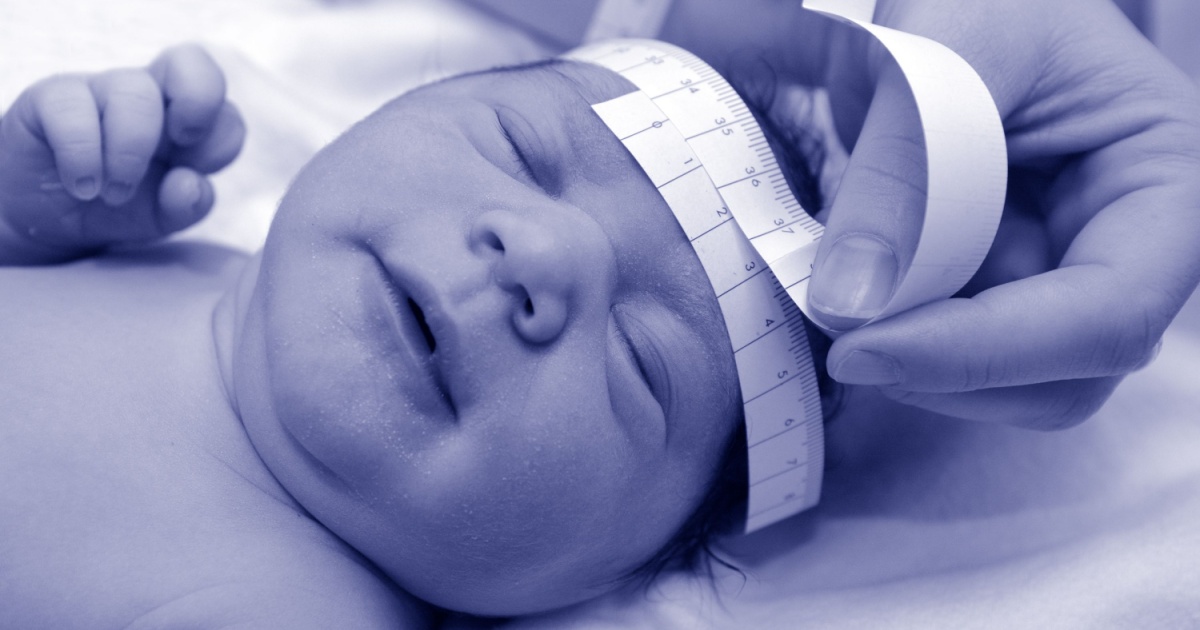 6 Surprising Physical Traits More Common in Autistic People