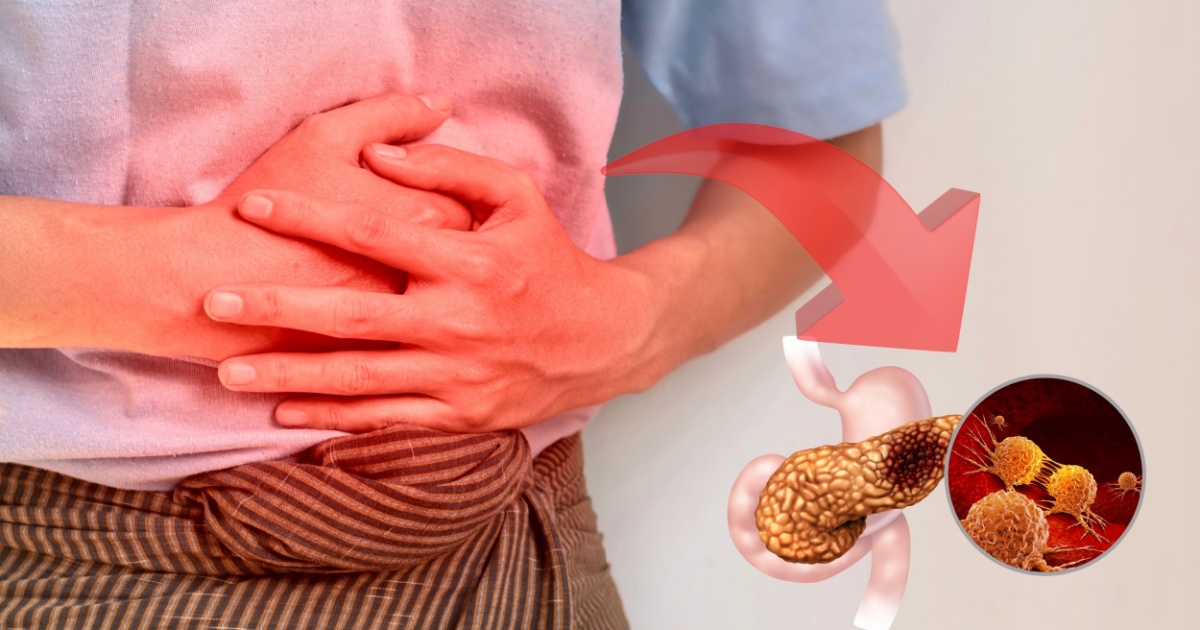 Recognizing Pancreatic Cancer Early: Subtle Symptoms That Matter