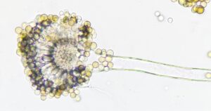 Mold species (Aspergillus sp) under microscope. Fresh sample whithout staining