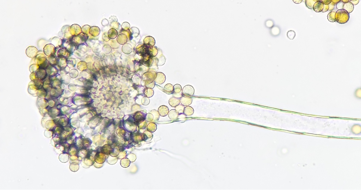 Rising Infections Put Several U.S. States on Alert Over Potentially Deadly Fungus