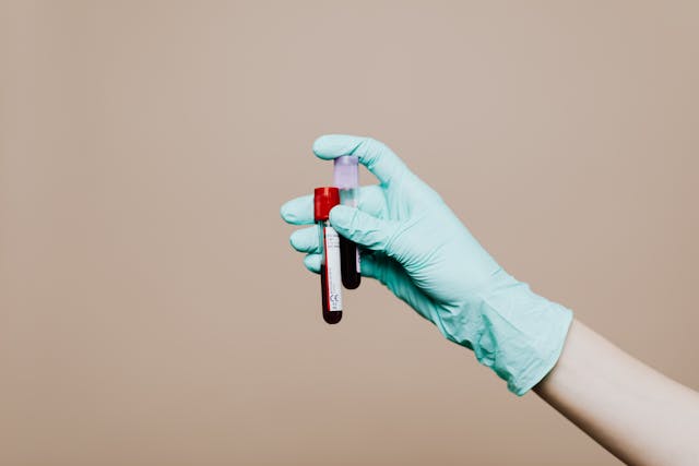 a gloved hand holding blood samples