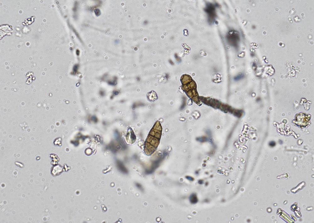 soil microorganisms under a microscope including amoeba, flagellates, nematodes, fungi, bacteria	