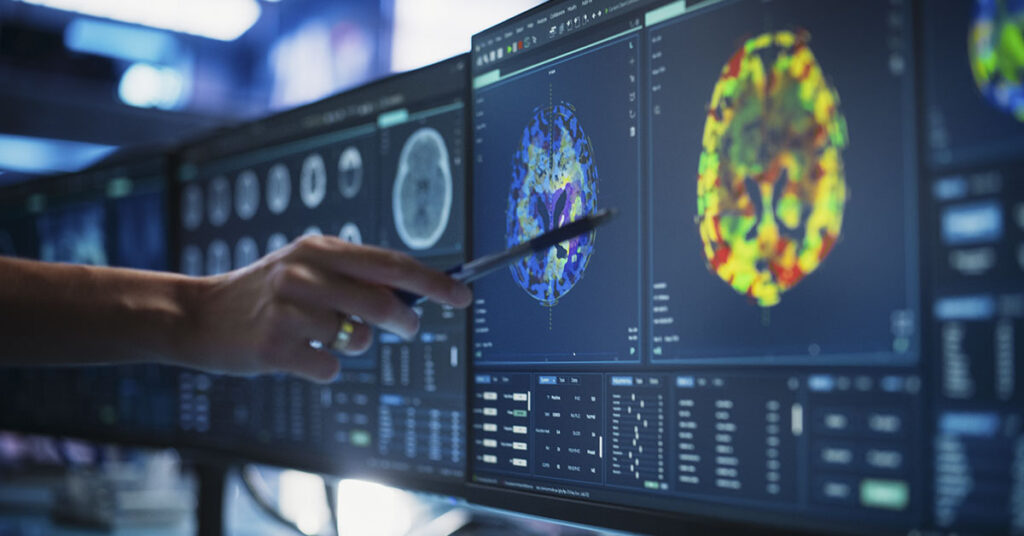 5 Morning Habits That Wreak Havoc on Your Brain, According to Experts - Featured image