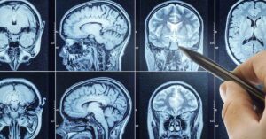 series of Brain MRI scans used for diagnostic imaging.