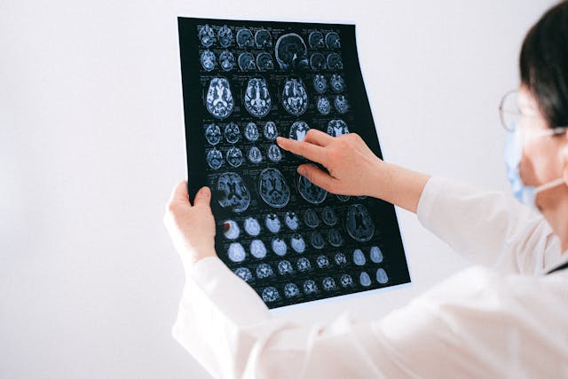 doctor examining brain scan