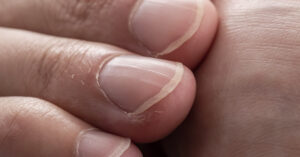 Close up of man's fingernails