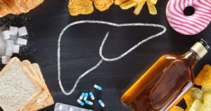 6 Surprising Things That Are Quietly Damaging Your Liver Right Now Unhealthy lifestyle and habits - risk of liver damage. Top view
