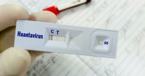 Hand of doctor holding a rapid test cassette for Hantavirus test, showing positive result, close up. Hantavirus